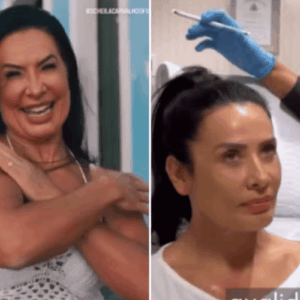 Scheila Carvalho sorridente após remover o preenchimento facial, mostrando um visual mais natural e rejuvenescida