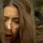 Feriha machucada após agressão de Mehmet