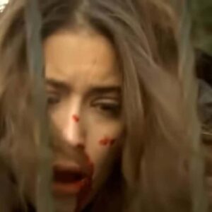 Feriha machucada após agressão de Mehmet