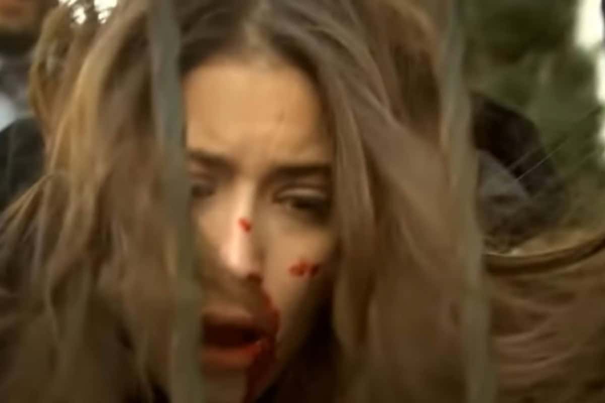 Feriha machucada após agressão de Mehmet